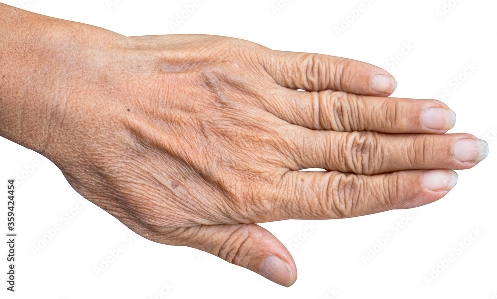 The back of the hand on an old Asian woman solated white background, close up. The back of the hand on an old Asian woman solated white background, close up.