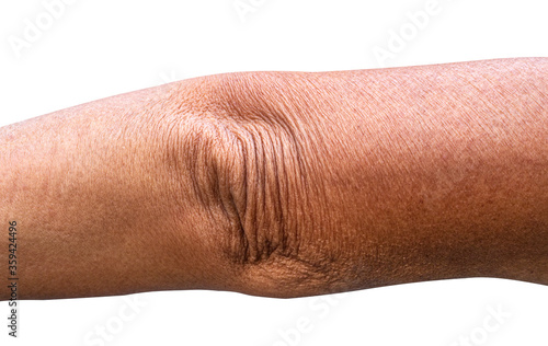Canvas Print Wrinkled elbow and arm  Asian  old  woman solated white background, close up