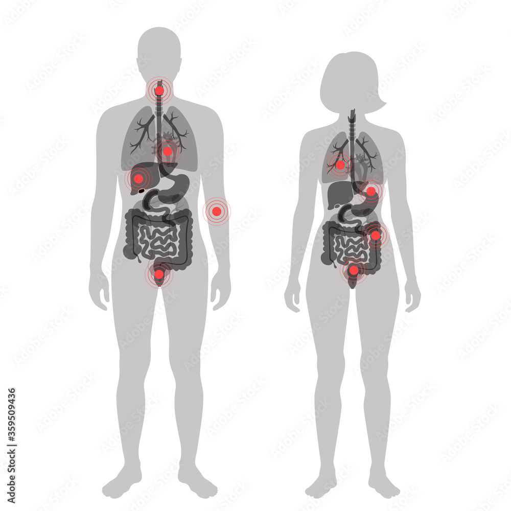 Pain in human body Pain in human body