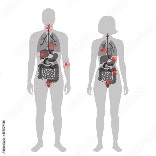 Pain in human body