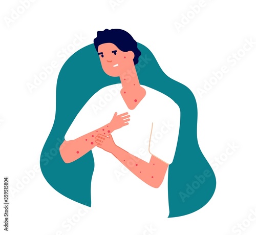 Scratching skin. Man sick, season allergy or roseola symptoms. Virus disease, scabies or adult chickenpox vector illustration. Sick skin man, disease scratch, rash itchy