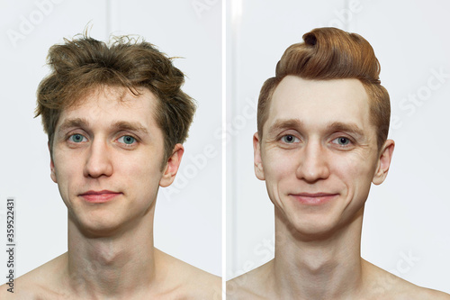 guy before after haircut Concept for a barber shop: the problem man of hair loss, alopecia, transplantation.