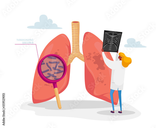 Pulmonology Specialist, Professional Doctor Character Holding X-ray Image of Lungs Learning Patient Fluorography with Tuberculosis or Pneumonia Disease, Medical Staff Work. Cartoon Vector Illustration