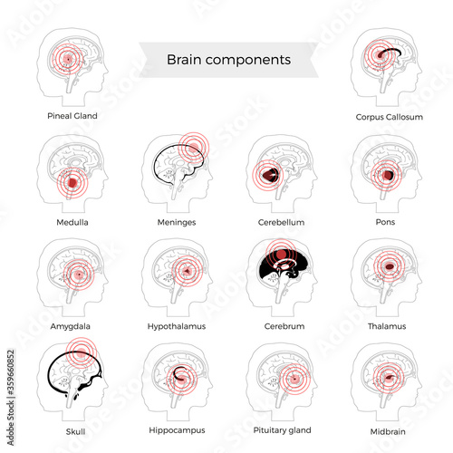 Pain Brain Illustration