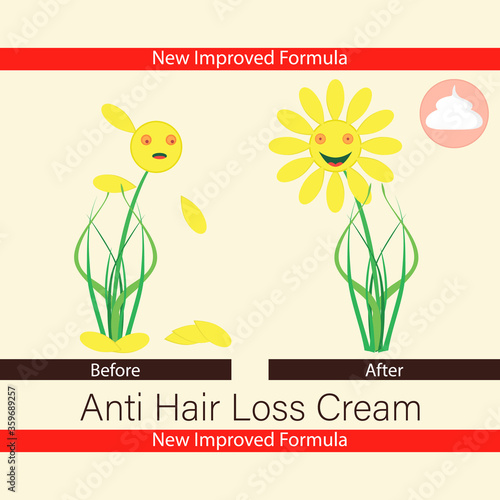 Anti hair loss cream. Balm, ointment for growth hair. Treatment of baldness and alopecia. Before and after. Label template. Hairless and hairy flower. Vector illustration.