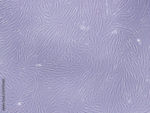 Fibroblasts ,the most common cells of connective tissue in animals, were captured by Light Microscope (40x) photo