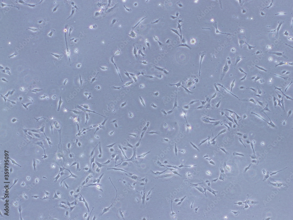 The Hcmec/D3 Cell Line As A Model Of The Human Blood Brain Barrier – MYHB