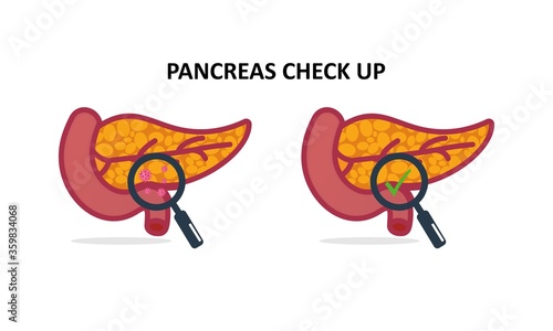 Magnifying glass looking human pancreas. Illustration Icon about health check up for diagnose disease.