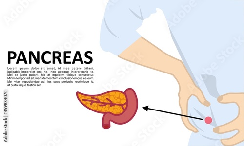 Pancreas. Modern medical infographics. Internal organs in a human body. Anatomy of people vector Illustration 