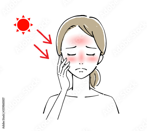 女性の顔　日焼け