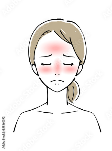 女性の顔　日焼け