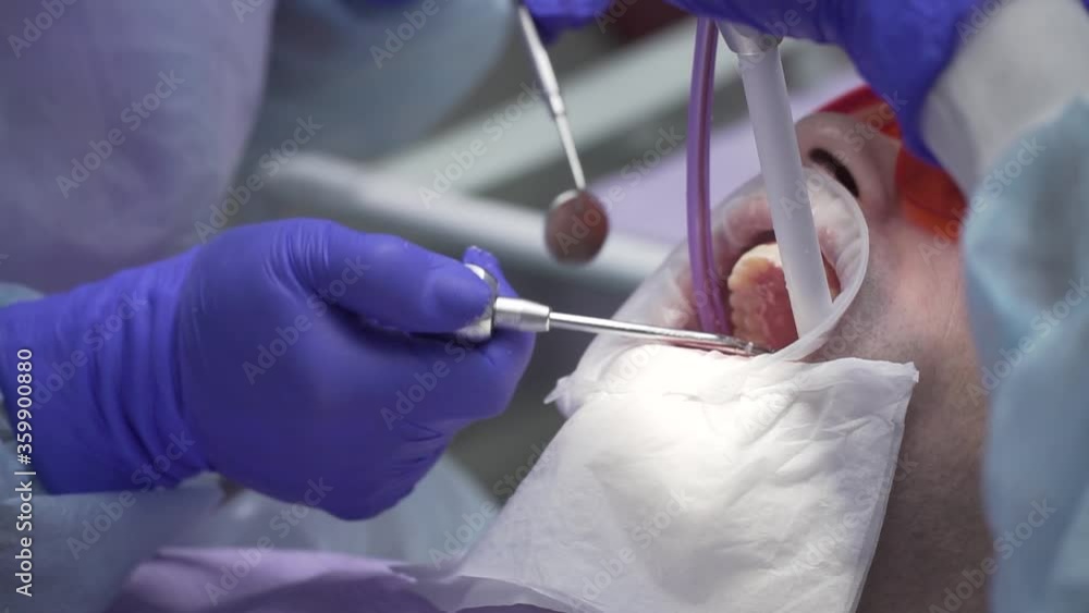 dentist conducts dental hygiene to the patient dentist conducts dental hygiene to the patient
