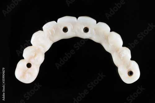 high-quality temporary dental template made of polymer, shot from above on a black background