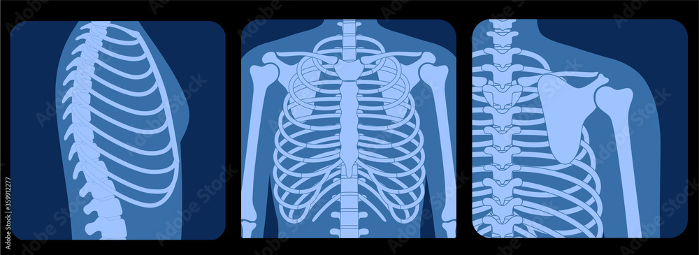 Skeleton x ray