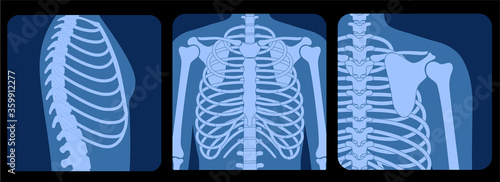 Skeleton x ray