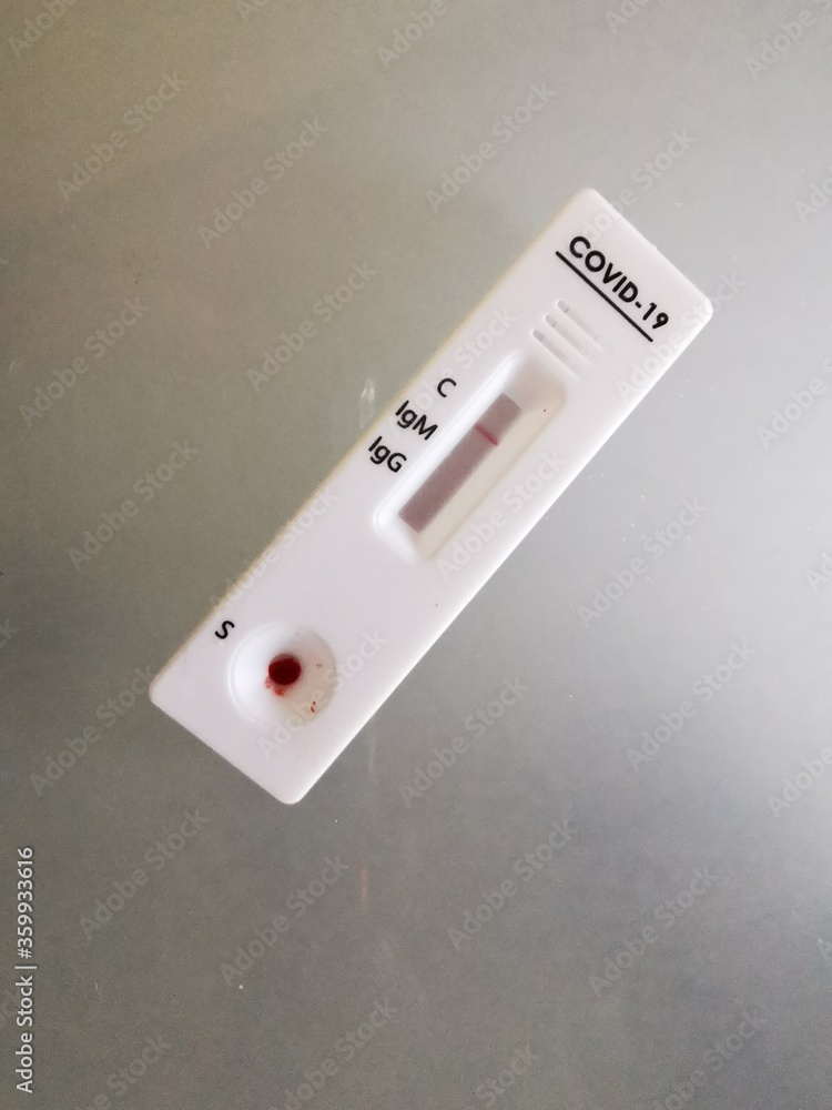 Negative test result by using rapid test device for COVID-19, novel coronavirus 2019 found in Wuhan, China. Negative test result by using rapid test device for COVID-19, novel coronavirus 2019 found in Wuhan, China.