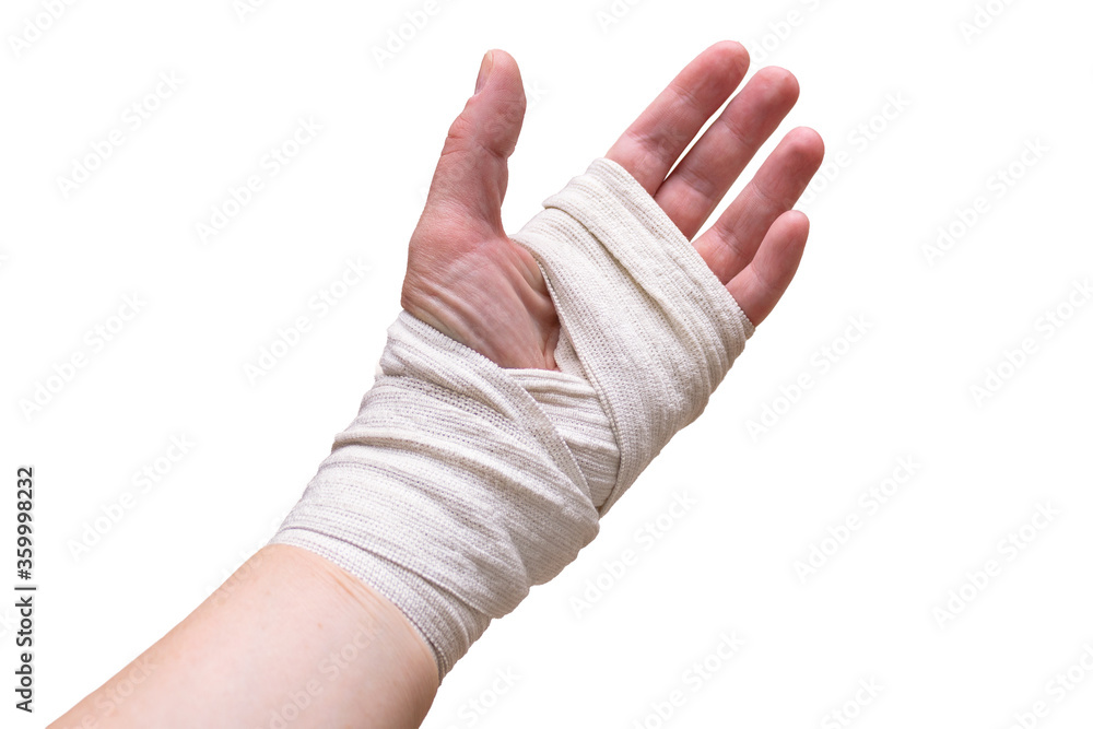 Bandaged broken hand palm up. Isolated on a white background. Bandaged broken hand palm up. Isolated on a white background.