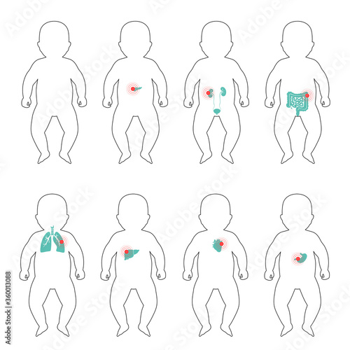 Pain in human body
