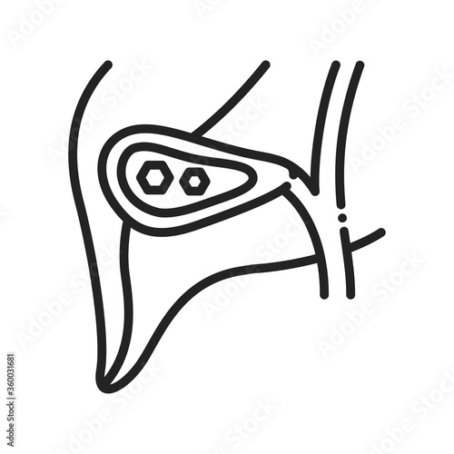 Pancreatic stones black line icon. Acute pancreatitis. Human organ concept. Sign for web page, mobile app, button, logo. Vector isolated element. Editable stroke