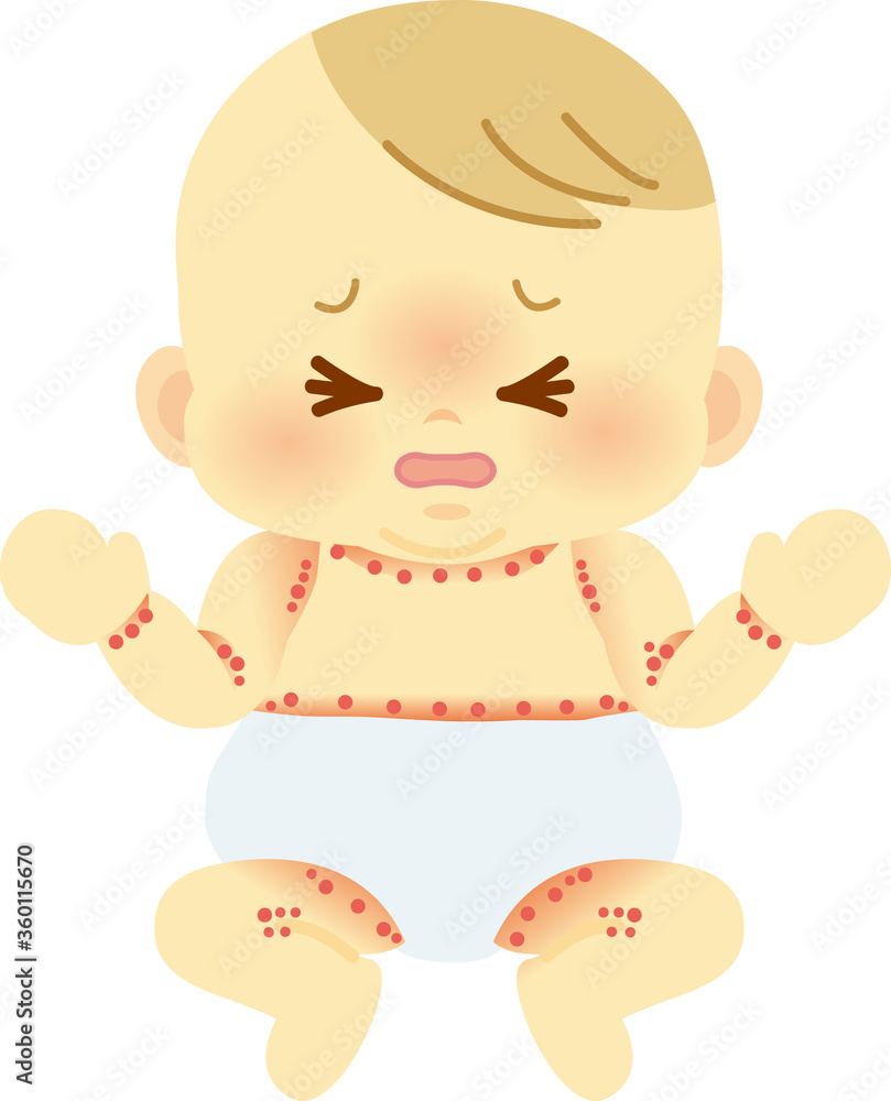 あせもの出来やすい部分を示したおしめ姿の赤ちゃん ベビー全身イラスト22 Stock Vector Adobe Stock