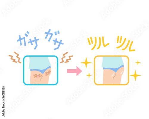 お尻の黒ずみや角質がツルツルになったイラスト