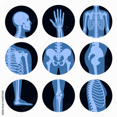 Skeleton x ray