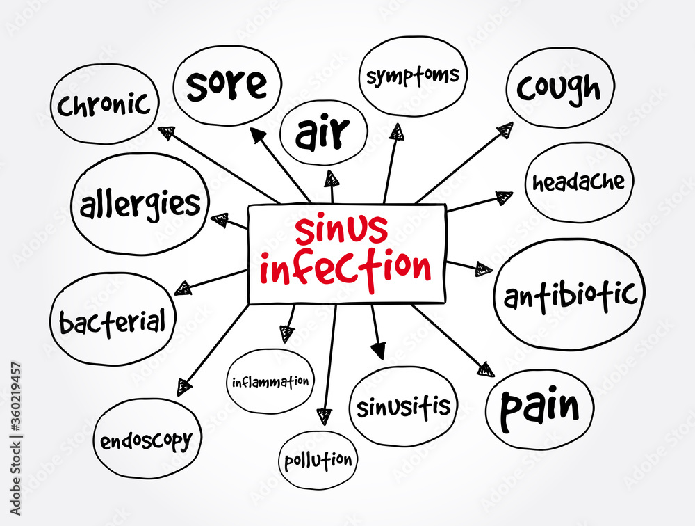 Sinus Infection mind map, medical concept for presentations and reports