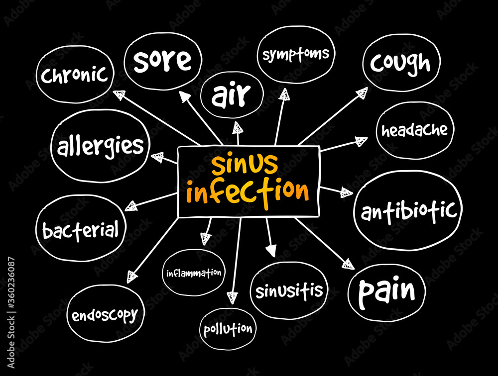Sinus Infection mind map, medical concept for presentations and reports Sinus Infection mind map, medical concept for presentations and reports