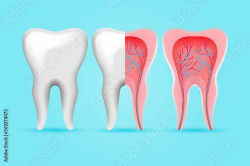 Internal and external tooth set