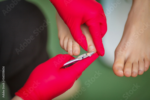 Podiatrist treating toenail fungus. Podology treatment. Close-up.