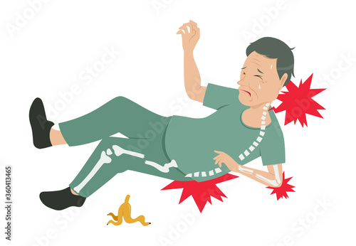 old man falling accident with bone fracture cartoon