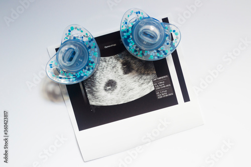 Twin pregnancy ultrasound. Two soothers and an ultrasound picture of two babies.
