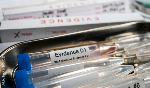 Hematological analysis with forensic test kit in a murder in a crime lab, conceptual image