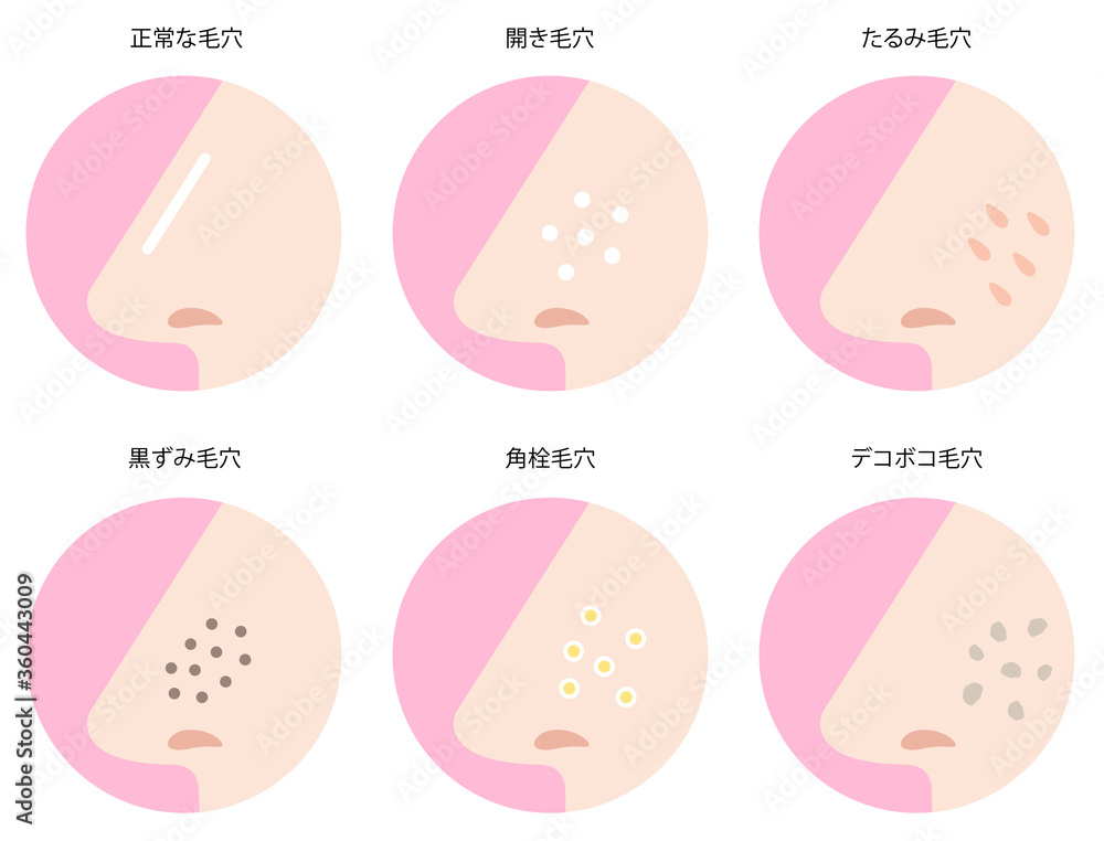 鼻の毛穴の悩み セット 鼻の毛穴の悩み セット