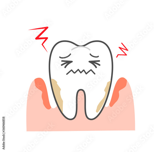 Periodontal disease bleeding toothpaste