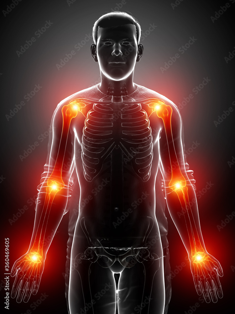 3d Illustration of men arm joint pain 3d Illustration of men arm joint pain