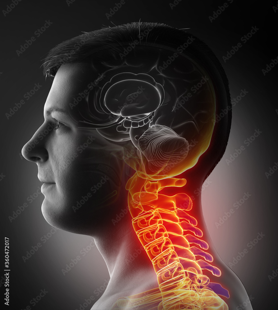 Obraz premium 3d rendered, medically accurate illustration of male having a painful neck