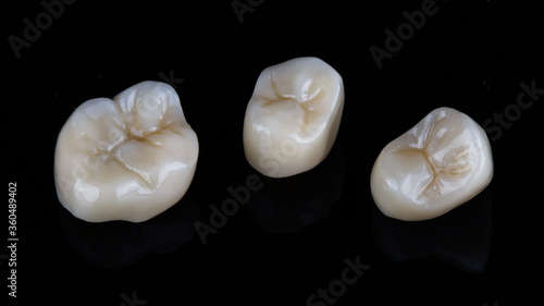 three high quality dental crowns on a black background