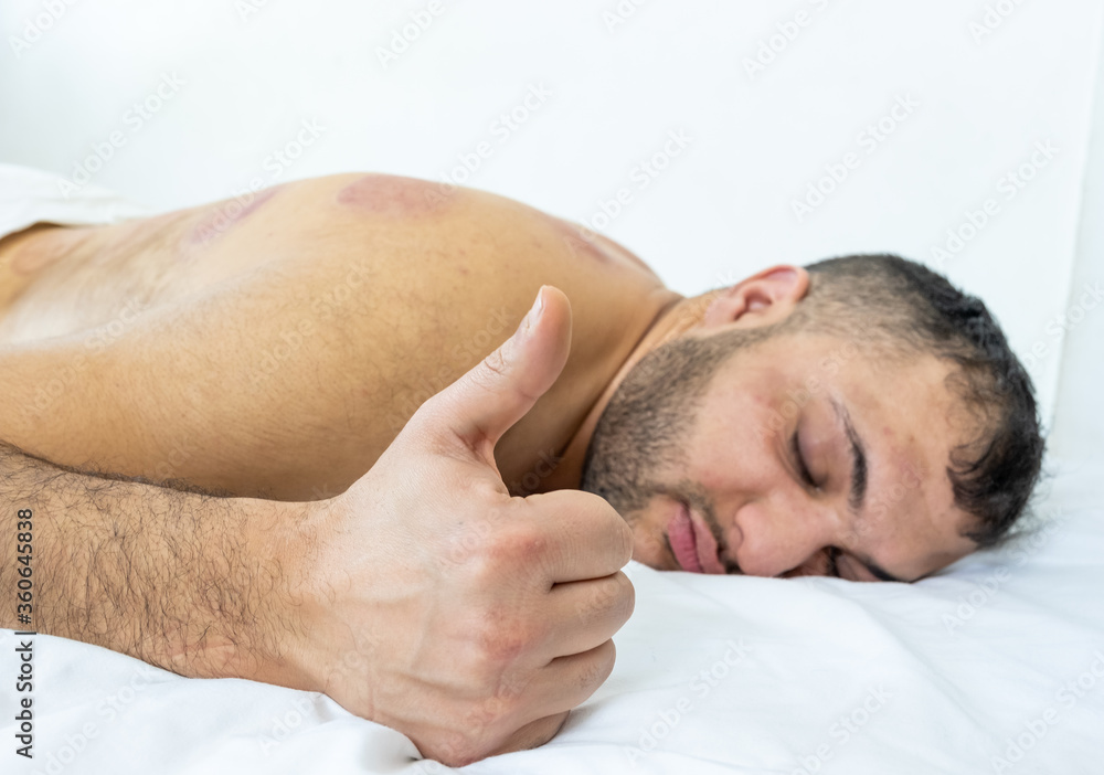 Arabic muslim feeling relax after cupping his back Arabic muslim feeling relax after cupping his back