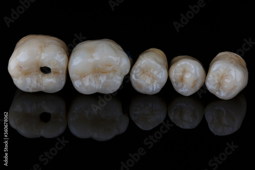 ceramic crowns on the anatomy side on black glass with creative reflection