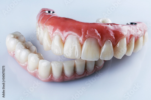 ceramic dental dentures of the upper and lower jaws for fixation on four implants on a white background