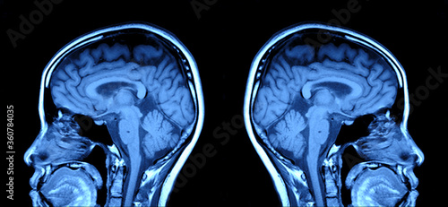 mri ct scan brain image photo