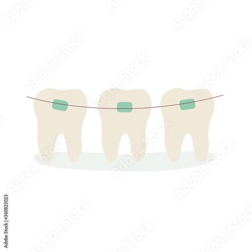 Teeth with braces. Vector illustration isolated on a white background.