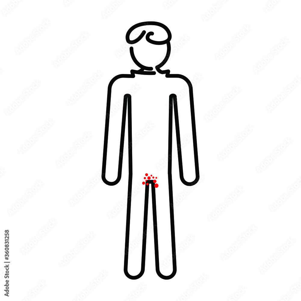 A simple stylized vector image of a man with a rash in the groin area. The concept is skin and venereal diseases, their treatment and prevention.