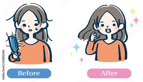抜け毛　気にする　女性　ビフォーアフターイラスト