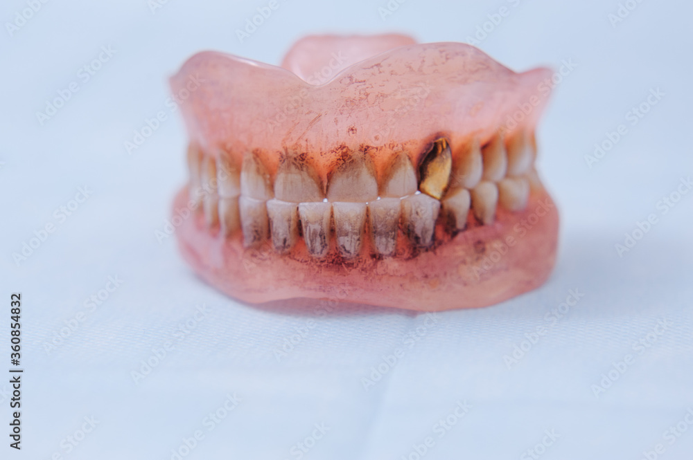 custom made wallpaper toronto digitalClose-up an acrylic denture prosthesis of the upper and lower jaws of a man