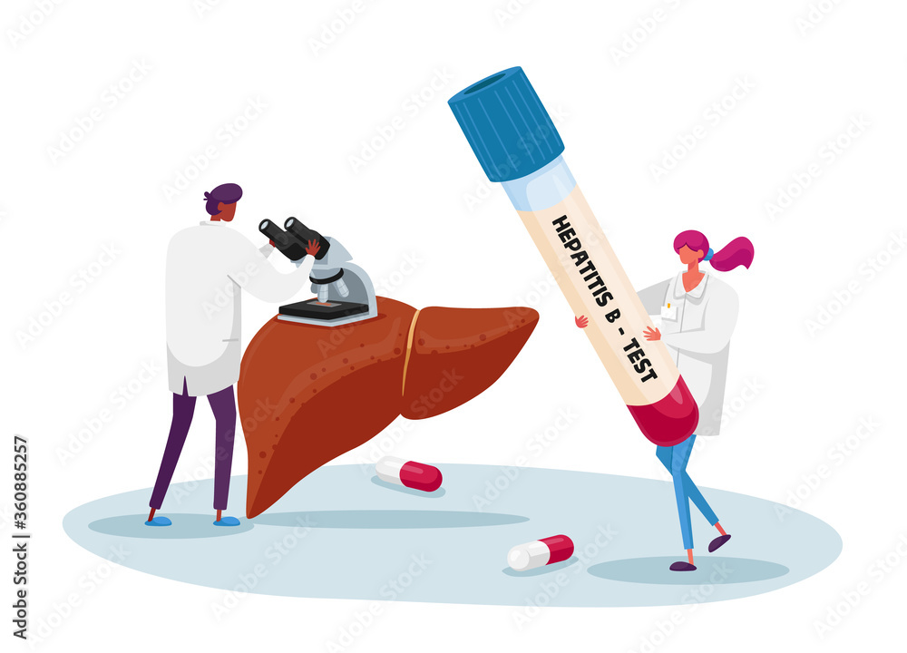 Blood Test on Hepatitis B. Doctor Look in Microscope, Nurse Character Carry  Huge Test Tube with Lifeblood. Medical Healthcare, Transfusion Charity in  Donation Lab. Cartoon People Vector Illustration Stock Vector | Adobe
