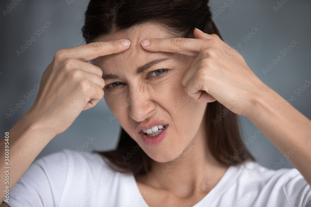 Anxious young woman feel unhappy with skin look in mirror squeeze pimple on forehead, worried dissatisfied millennial female frustrated with acne or wrinkle, cosmetology, skincare concept Anxious young woman feel unhappy with skin look in mirror squeeze pimple on forehead, worried dissatisfied millennial female frustrated with acne or wrinkle, cosmetology, skincare concept