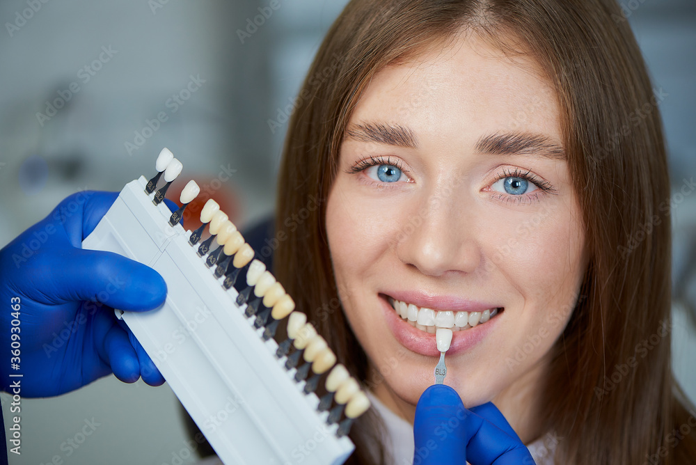 A close photo of a teeth shade sample that is matching to a smiling female patient in a dental chair. A doctor is checking teeth color samples before treatment procedure in a dentist's office.