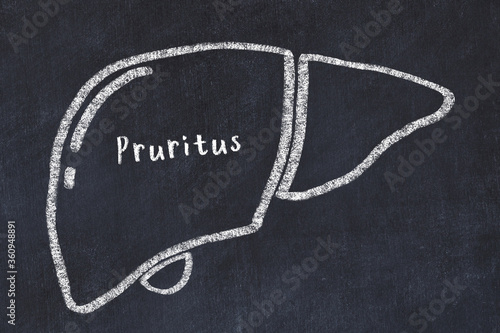 Photos Chalk drawing of human liver with medical term